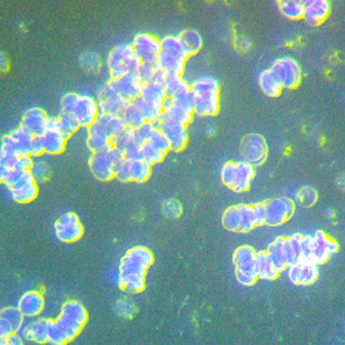 before meditation darkfield microscopy life under the lens