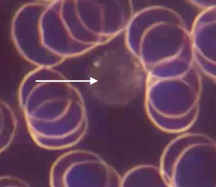 lymphocite lymphocite