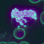 The Basophil’s Secret Signals