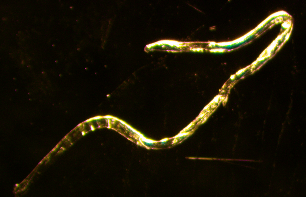 Strongyloides stercoralis or Ancylostoma duodenale
