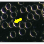 Single Membrane Protrusion