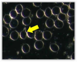 Single Membrane Protrusion