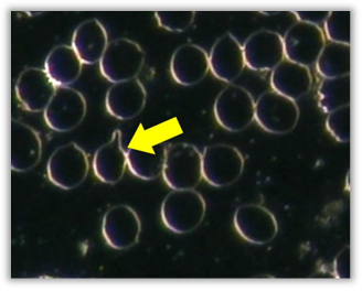 Single Membrane Protrusion