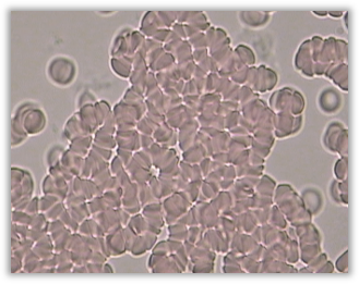 Erythrocyte (RBC) Aggregation