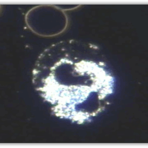 WBCs with Translucent Membrane