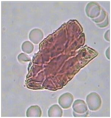 Orange-red-brown Crystals