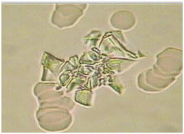 Kidney stress crystals