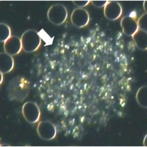 Thrombocyte Aggregation