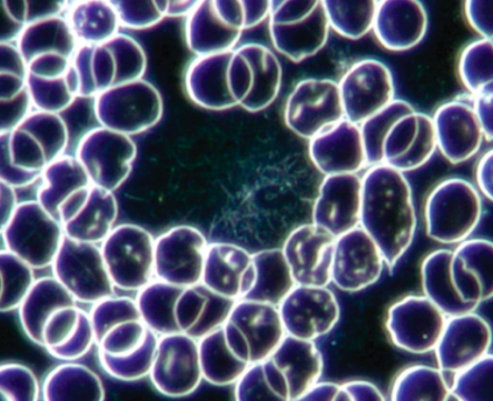 Fermentation on Red Blood Cells